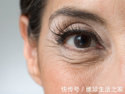 莱菔子|55岁女子高血脂入院,医生:一旦皮肤这3个处“亮起红灯”,请及时检查