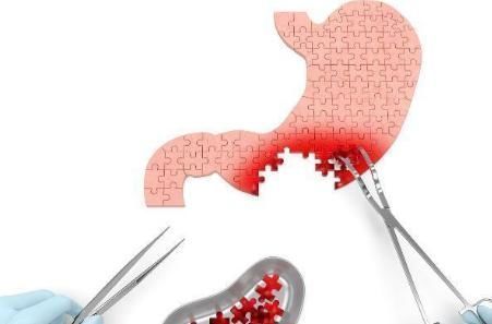 杀灭|胃不好的人，早起喝“3水”，可杀灭”幽门螺杆菌“，预防胃癌