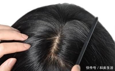 发色|那些年买假发踩过的雷区!零经验者都爱这样选,但却大错特错