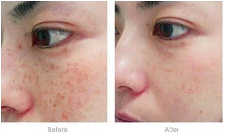 改善 你做的医美项目做对了吗?干货整理!