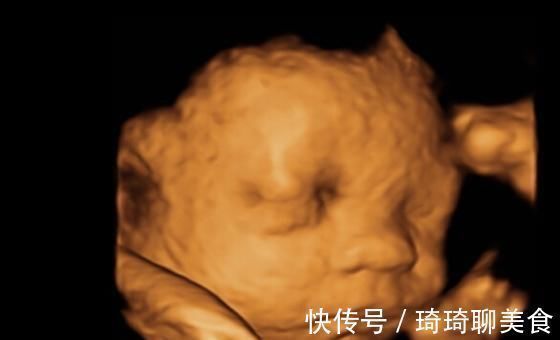 胎儿|孕妇做四维彩超,胎儿鼻子扁又大,胎儿也是有苦说不出啊!