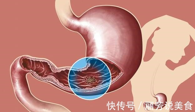 消化内科|女子头晕半年,以为患癌症,检查结果让她觉得重获新生