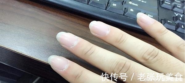 缓解|手上有处“通便穴”,经常掐一掐,泻火消肿,便秘烧心也不见了!