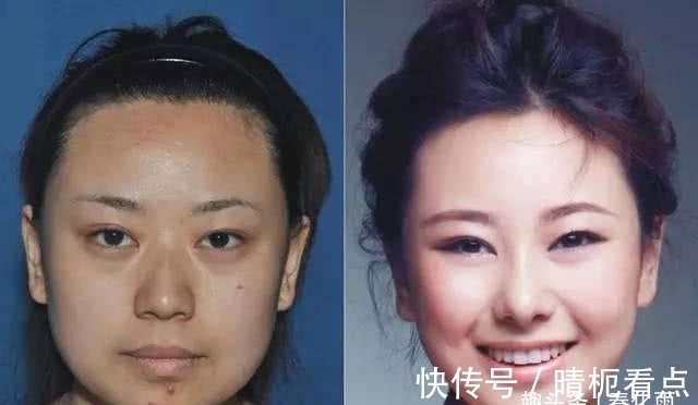 美白|实拍:10张女孩整容前后的对比照,这真就是换了一张脸
