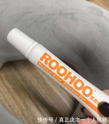 身体|剖腹产两次,身体会有什么变化?