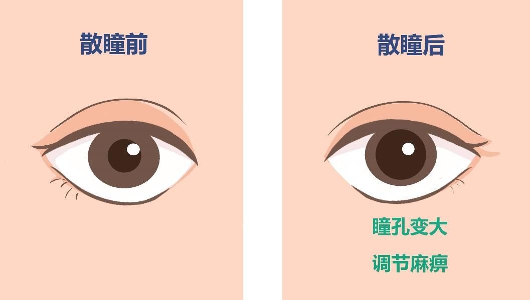 屈光|科普解读丨验光配镜的这些小常识，你知道吗？