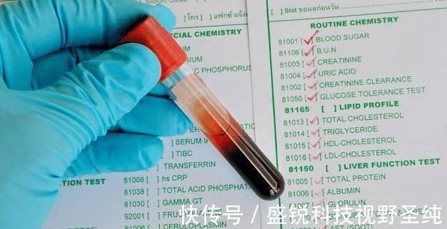 癌症|血常规能查出癌症吗?医生:“揪出”早期癌症,不要放过这3项