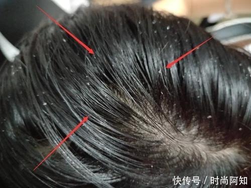 油头首选控油洗发水,拯救“油头星人”,放肆凹造型