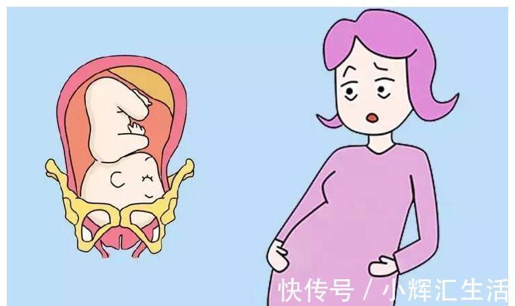 胎儿|孕晚期常做4个动作,胎儿入盆快分娩少遭罪
