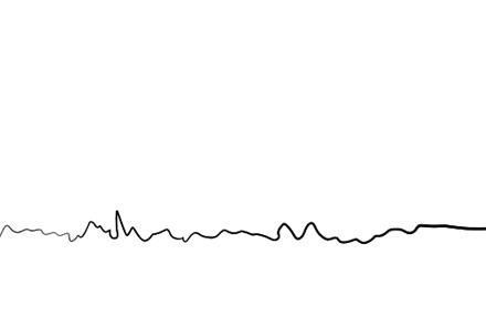 母细胞瘤|他曾是星光大道总冠军,爆红后被导演骂滚出娱乐圈,如今怎样了?