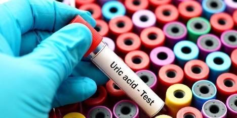 尿酸高的人，哪些食物不可以吃？看完以后，不要再偷偷的吃了