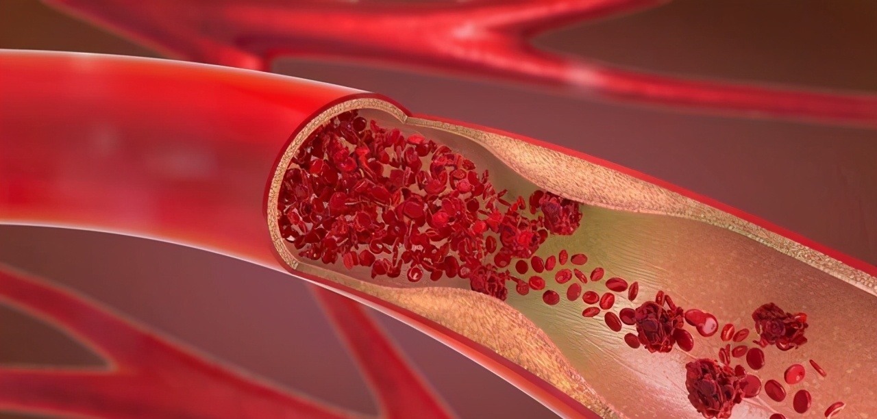 我是大医生|寿命长的人,通常有“2软3小”,占一个也值得恭喜,身体比较好