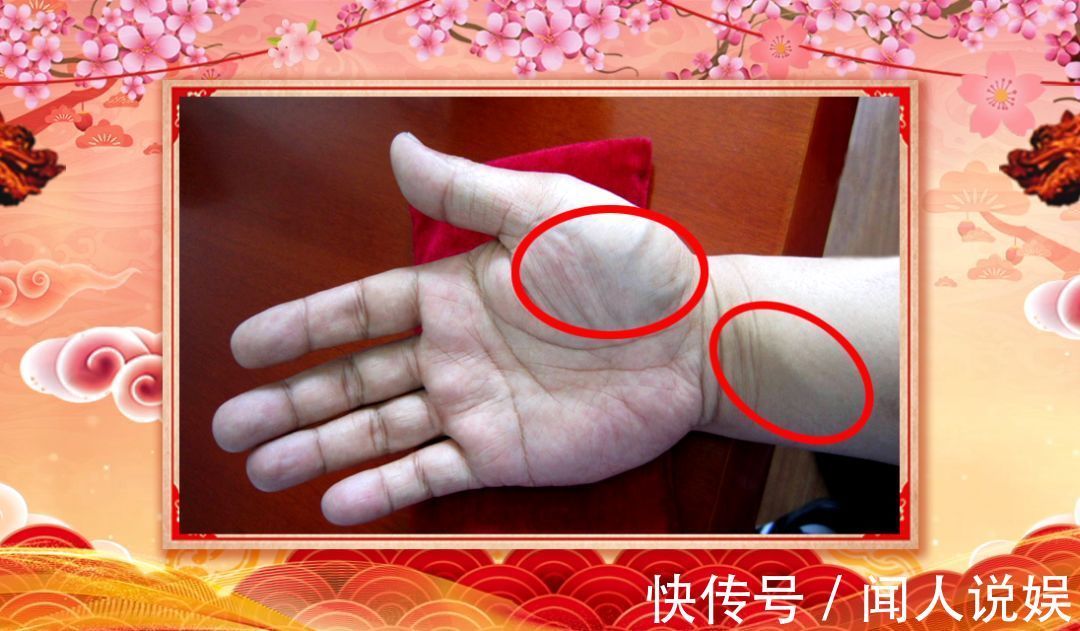 青筋|身体好不好，看手就知道！这几处变化可能藏大病