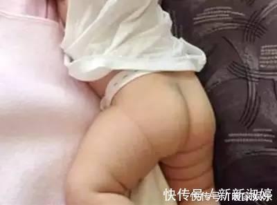 蒙古斑|为什么宝宝的屁屁都有青痕,其实屁屁上有青痕的宝宝都是有故事的