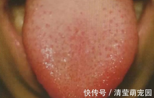 大鱼际|手上有个“救心穴”，长期按一下，心脏血管也就通了