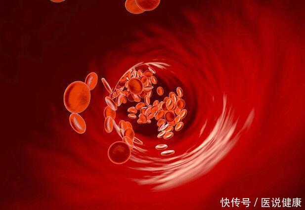 血管硬化有4个症状!忠告:坚持“3多2少”,血管慢慢恢复弹性