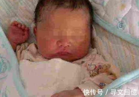 幼儿园|宝宝贴着避孕环出生,医生说发育受影响,上幼儿园后才知道真相