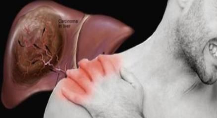 胡萝卜|养肝“冠军”找到了,不是胡萝卜,敞开吃,肝硬化或“不攻自破”