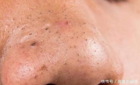 肾脏|“肾好”的男人才好若身体出现“3黑1臭”,多半是“肾”在求救