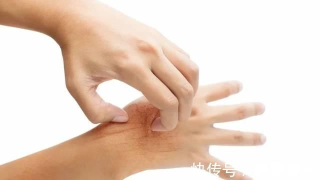 皮肤瘙痒|寿命短的男性，有4个地方比较“痒”，哪怕少占一个，也要偷着乐