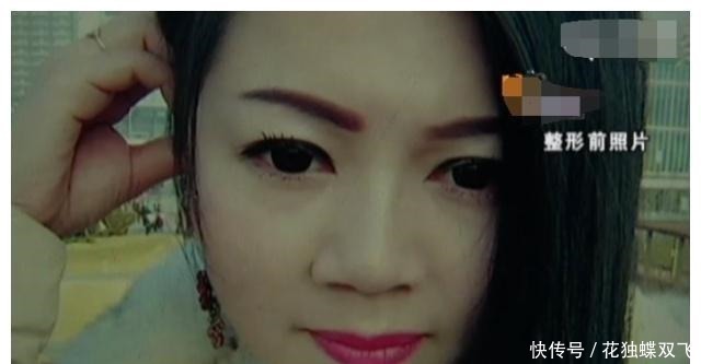 鼻子|整形三年,老公也忍不了了花钱整成猪一样!女子曝光求助