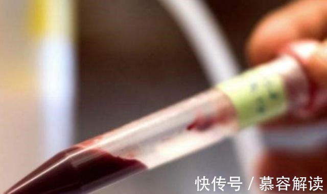 抗体|若准妈妈是这血型,你和孩子都有福气,第一胎尽量不要打掉