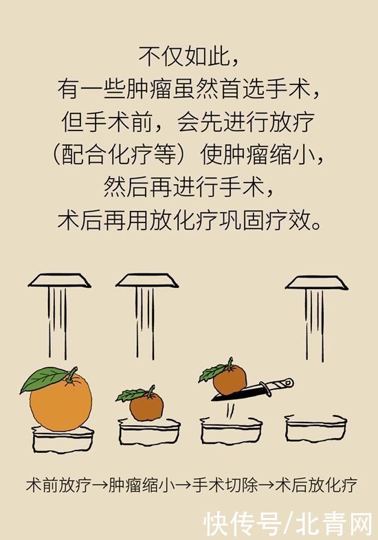 肿瘤|一半以上的肿瘤需要放疗，害怕辐射不如了解一下