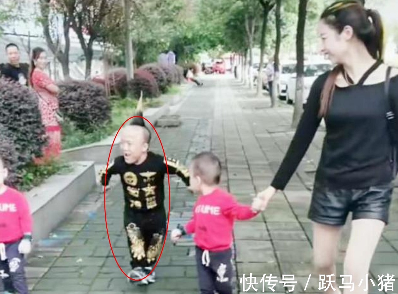 缺陷|“袖珍丈夫”走红,和妻子牵娃上街,路人问宝妈3个都你生的