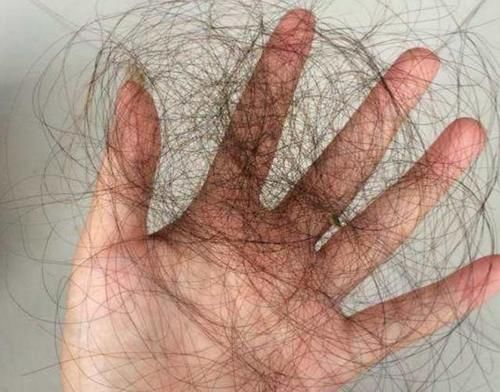 内分泌|女性有7种“丑态”,或在暗示内分泌失调!坚持好习惯,气色更佳