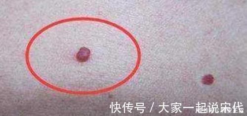 肝脏|此物是天然“解毒王”，每天常吃点，养肝排毒，肝病或不攻自破