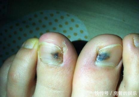 肾脏|“肾好”的男人才好若身体出现“3黑1臭”，多半是“肾”在求救