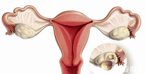 乳腺结节|离癌还远的，身上有没有4个“小突起”，占一个也好，你了占几个