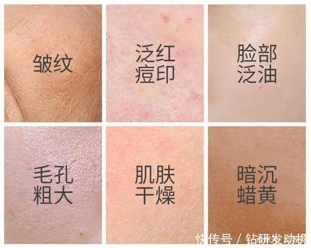 封闭剂|秋冬季科学补水保湿,护肤品中一定不能少了这些成分……