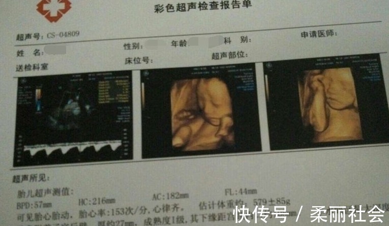 四维彩超|四维彩超单上4个数据,暗示了胎儿秘密,你知道了吗?