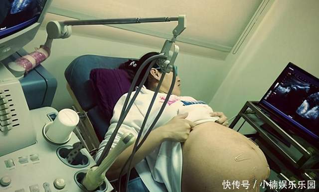 医生|怀孕8个月,产检被告知多条腿,娃生下全家乐了,网友反应很直接