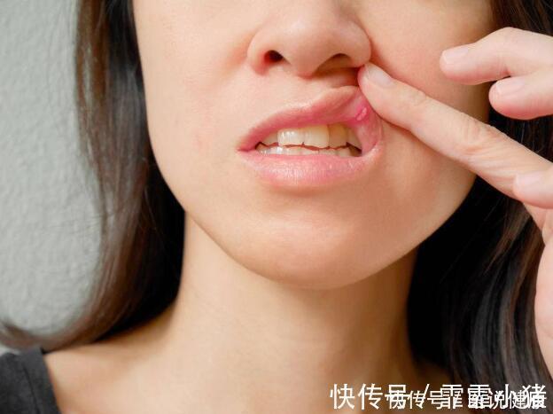 口腔疾病|无缘故的口干，是身体缺水了？提醒：口干也可能暗示这4个问题！