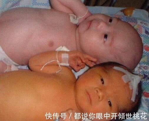 酸性|孩子出生后出现黄疸,多半是孕期时的坏习惯导致,要留心!