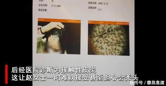 赵女士|做头发后,发际线高了不止两寸,女子当场蹦了!