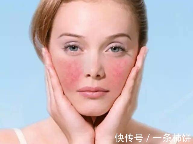 角质层|告别!九个闭口形成的原因!好皮肤才是仙女的本钱来一起变美吧