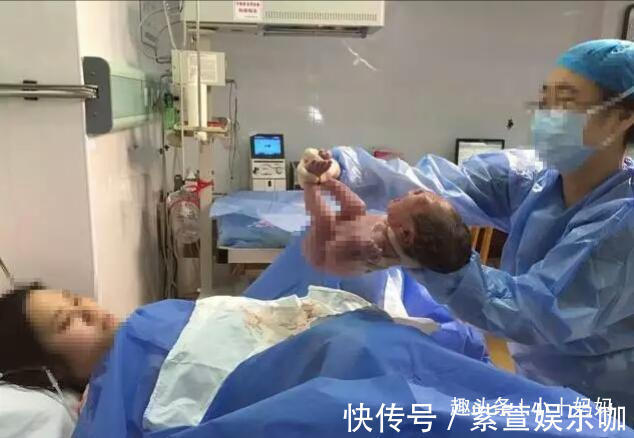 小萌|27岁产妈生下龙凤胎,刚要缝合时突然喊“等一下”,医生都愣住了