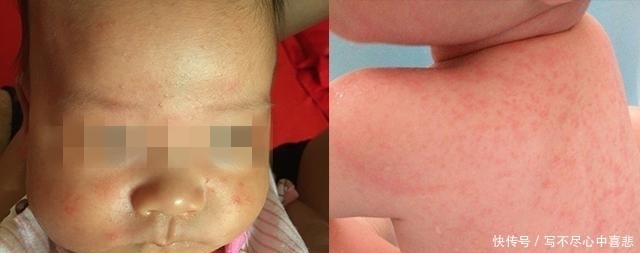 方法学|为避免宝宝得“空调病”就不开空调?正确开空调的7个方法学一下