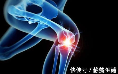伤害|膝盖有响声是关节炎吗？伤害膝盖的这些习惯，第2个你我都有