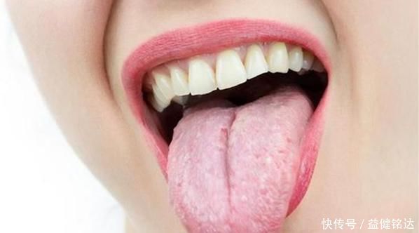 身體若出現(xiàn)以下3個表現(xiàn),說明體內(nèi)濕氣很重,該祛濕排毒了!