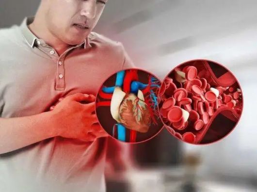 胸痛|专家提醒：年轻人心律失常，与这些有关！