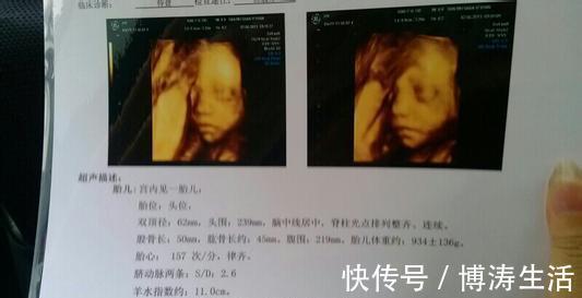 黄金时间|这是孕妈容易吃亏的产检,也是复查率较高的产检