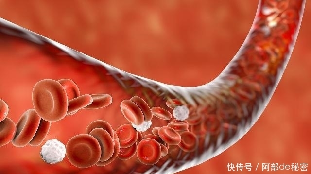 身体当中|血液粘稠的人,少吃2白、远离3件事,可能助你巧防“血栓”