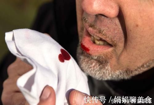 吸烟|吸烟是如何毁掉一个男人的？当身体发出明显信号，求你别再抽了