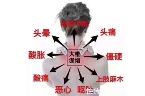 在职场|化解颈椎病的特效方,只有2味药,一补一通,谁用谁受益
