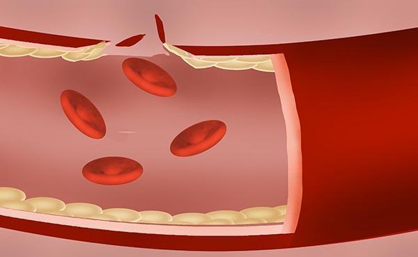雌激素|更年期是每位女性都要经历的阶段，当遇到时要有正确的处理方法
