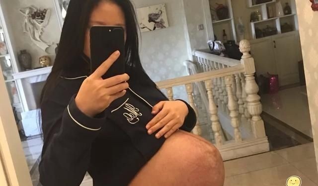 准妈妈|明明怀胎十月,为啥准妈妈的孕期才280天预产期医生咋计算的